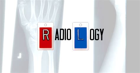 Captivating Radiography: The Allure of Magical Radiographic Markers